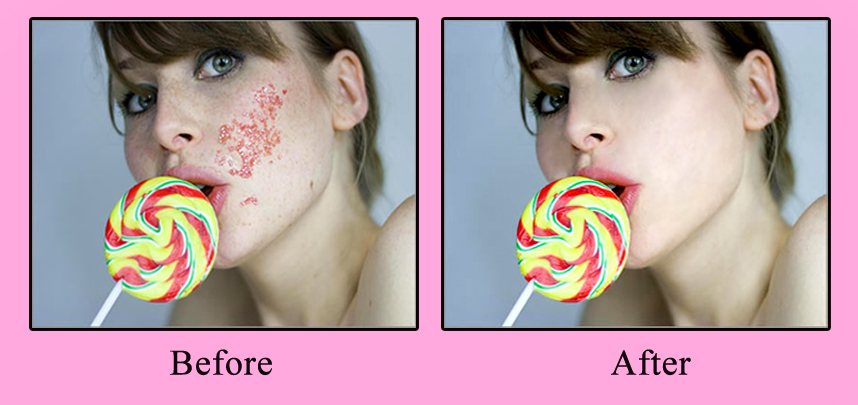 David Richardson - Skin Blemish Removal